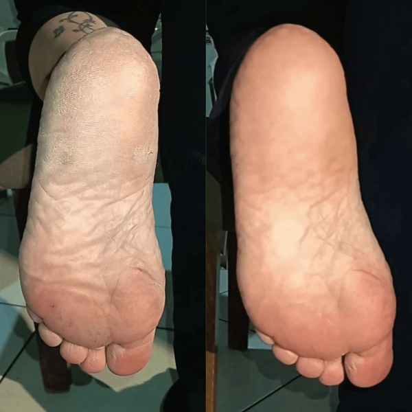 Antes X Depois (Post para Instagram (45)) (2) Antes X Depois (Post para Instagram (45)) (2)