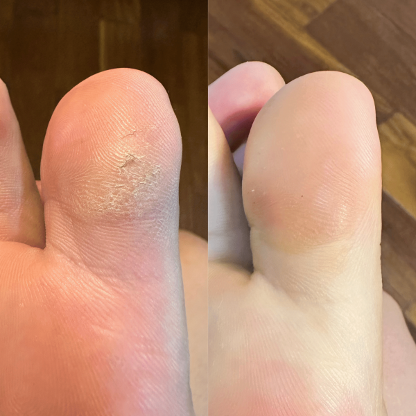 Antes X Depois (Post para Instagram (45)) (5)